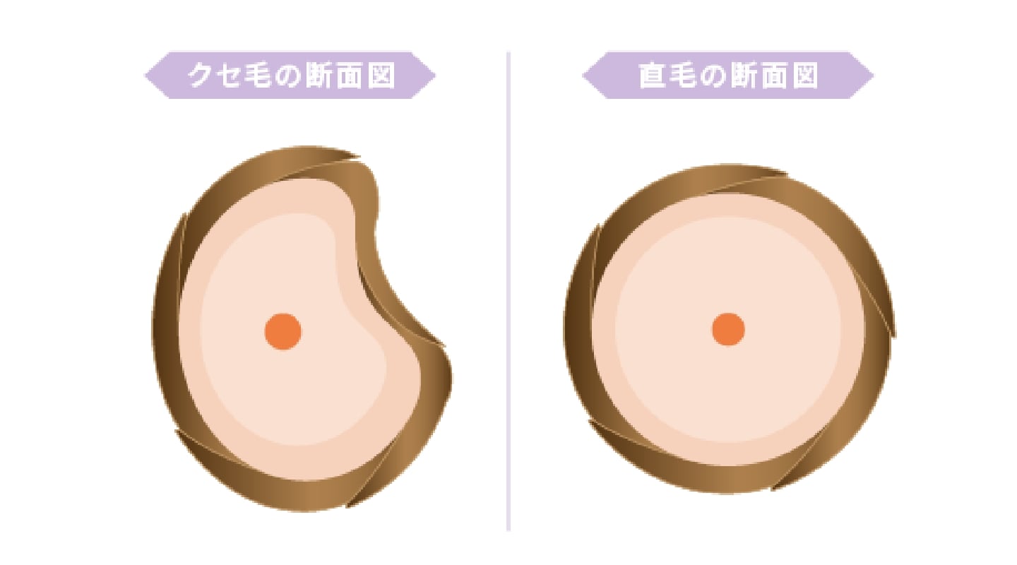 クセ毛と直毛の違いは？
